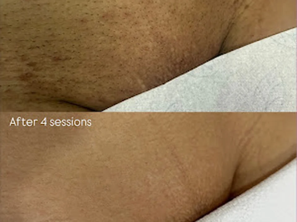Beauty Laser Studio