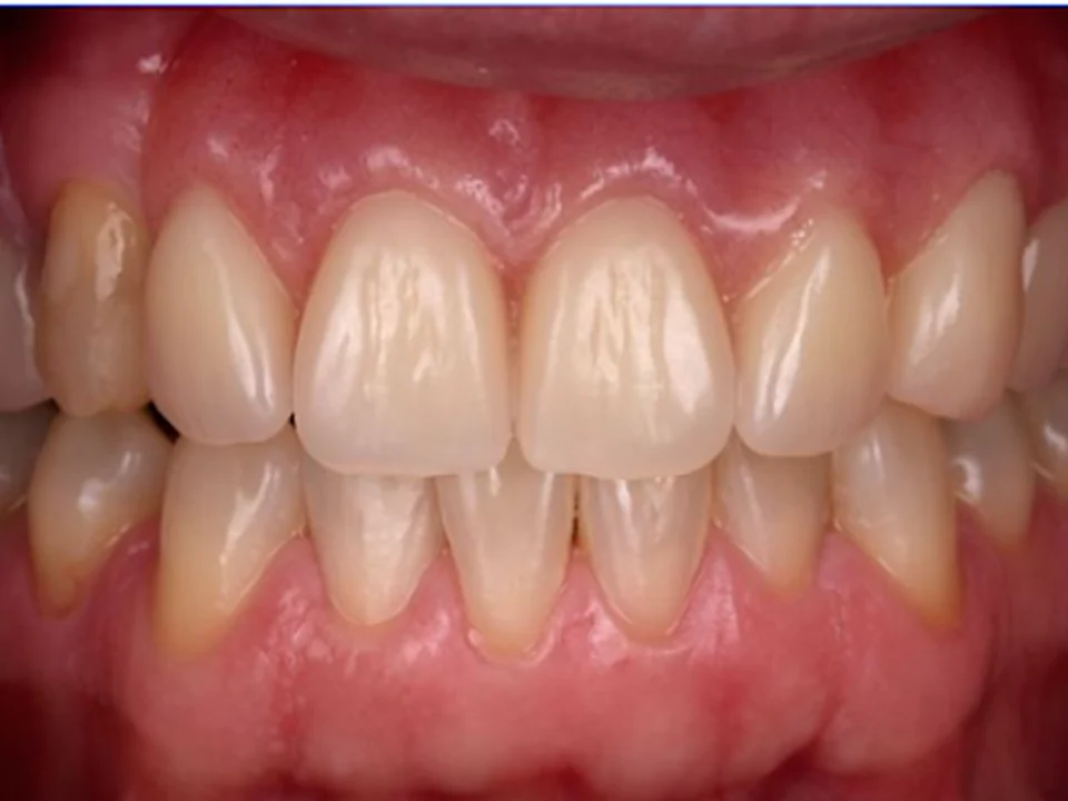 Boston Prosthodontics Dental Group
